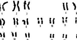 Международный день человека с 47 хромосомой